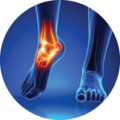 Advanced Foot and Ankle Specialists